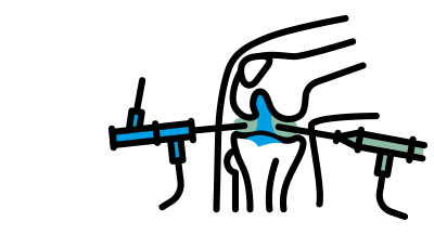 Artroscopia | ¿Qué Es La Artroscopia? | PortalCLÍNIC